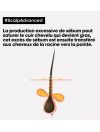 SHAMPOING DERMO PURIFIANT ANTI-GRAS SCALP ADVANCED - L'OREAL PROFESSIONNEL